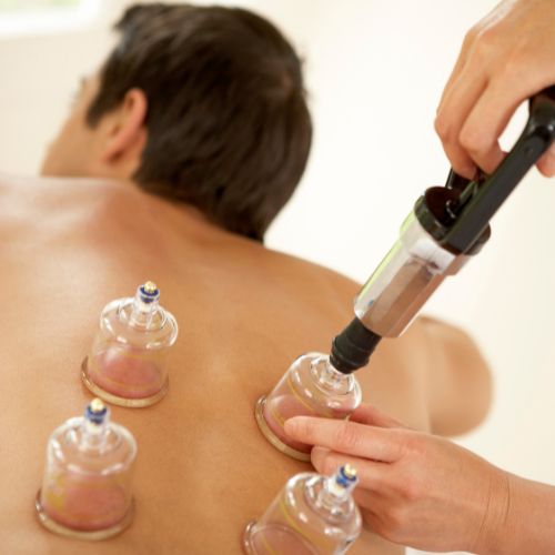 Dry Cupping Therapy in Noida